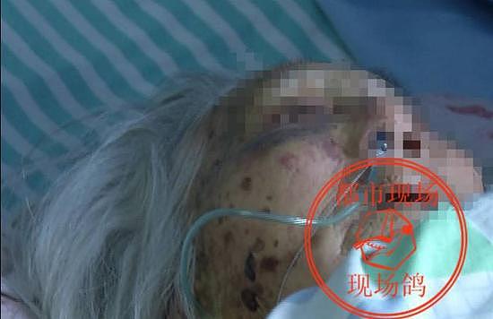 江西88岁老太遭暴打后被性侵 嫌疑人已被刑事拘留 - 4
