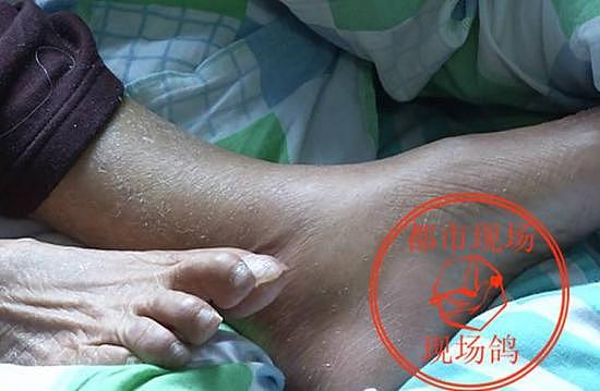 江西88岁老太遭暴打后被性侵 嫌疑人已被刑事拘留 - 5