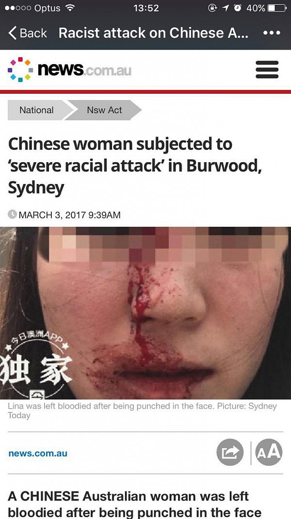 【更新：警方证实疑犯至今仍在逃】愤怒！澳洲华裔女子华人区当街无故遇袭！遭拳击面部血流不止！疑犯行凶时大喊：“滚出我的国家！”(图) - 3