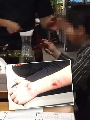 欺人太甚！中国留学生中餐馆打工被澳女暴打！女子吃霸王餐不够，还把人咬得去医院缝针！（视频） - 5