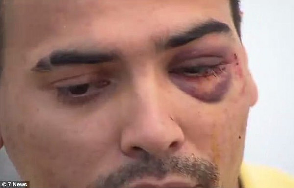 Mr Sandhu, who works as an Uber driver, reportedly suffered a fractured eye socket in the attack and can no longer drive his car