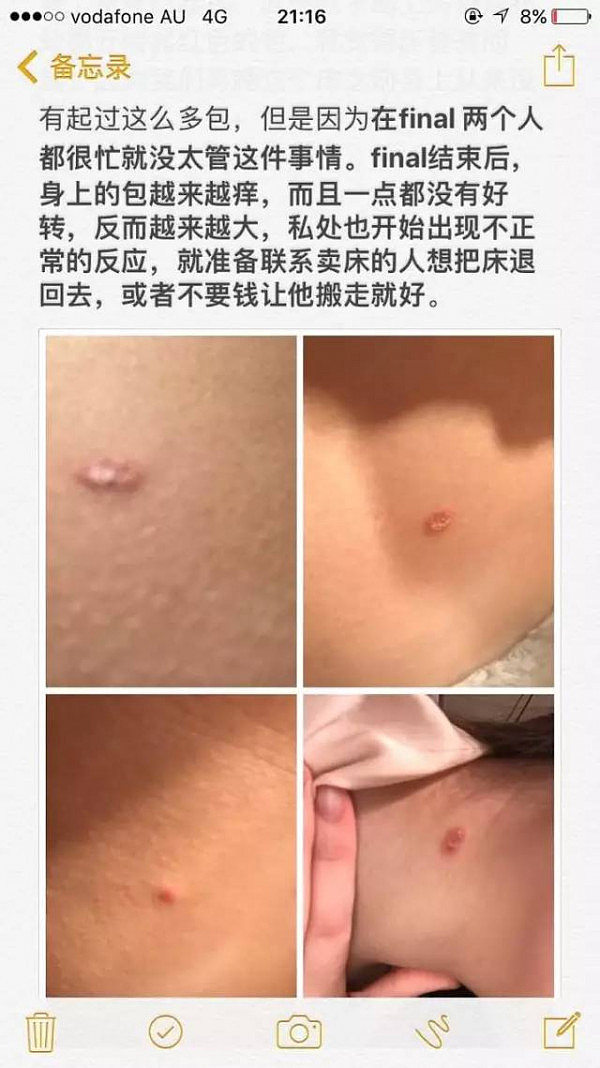 “咬得我女朋友全身都是红包！私处也被咬了！”悉尼中国留学生买个床垫子，竟然遭遇臭虫！（部分人恐对图片不适） - 1