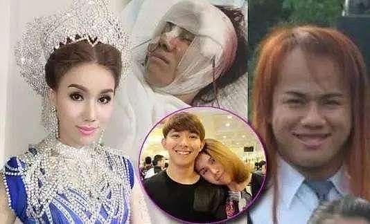 32岁泰国小伙整容上瘾，最后凭借美貌嫁给了富豪