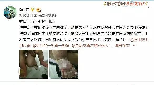 揪心！接连几个孩子双脚肿胀溃烂惨不忍睹，愚蠢家长拿孩子当“小白鼠”试验！（图） - 1