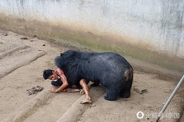 恐怖！泰国男子逗黑熊反被攻击 狂咬手臂需缝上千针（组图） - 2