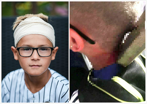 英国9岁自闭症男孩遭霸凌 生锈铁钉插入脑袋（组图） - 1