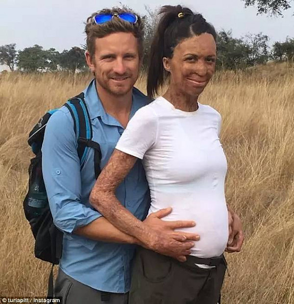 怀个孕也能轰动全澳洲？就因为她老公是全球公认最帅的男人！ - 25
