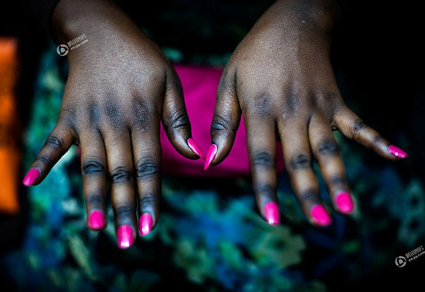 非洲的美白产业：黑人女子为变美将皮肤漂白（组图） - 3