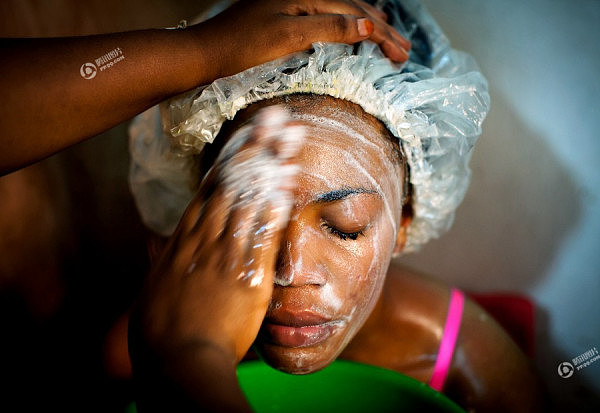 非洲的美白产业：黑人女子为变美将皮肤漂白（组图） - 8