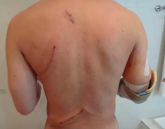 恐怖！澳华裔医生被患者连捅14刀 护士吓得哇哇哭 3年后的他怎么样了... - 5
