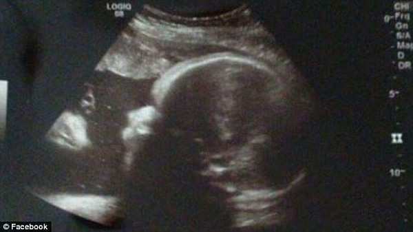 惊！怀孕女子做B超却看见“耶稣”凝视胎儿（组图） - 2