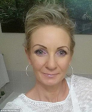 According to Medicine Net , erbium laser resurfacing is designed to remove surface-level and moderately deep lines and wrinkles on the face, hands, neck, or chest (pictured: Niki Richardson before)