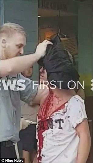 拳击界的世界大战！澳洲的观战粉丝们一言不合也开打！脖子被捅，头破血流…（视频） - 4