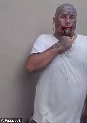 Blood oozed out of his mouth and down his white t-shirt