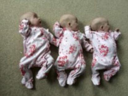 英国高龄产妇生同卵三胞胎 几率两亿分之一（组图） - 4