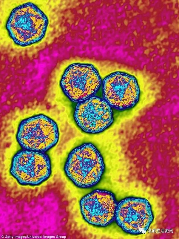 悉尼5周内已有12人染上甲肝！或因不洁食物造成 医生建议早注射疫苗 - 8