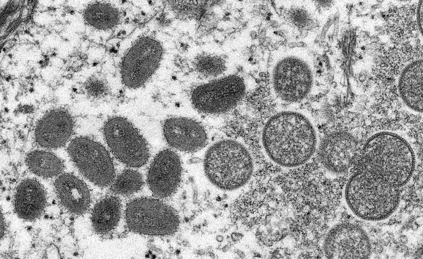 瑞士首次完成猴痘病毒的DNA测序工作 - 1
