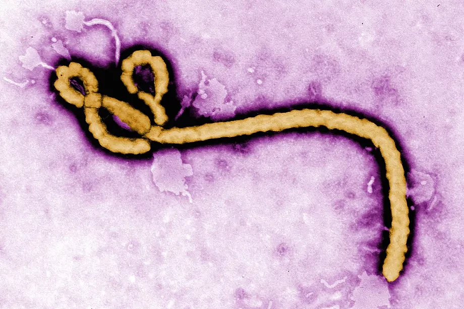 研究人员正尝试用人类抗体中和埃博拉病毒及其致命的“近亲” - 1