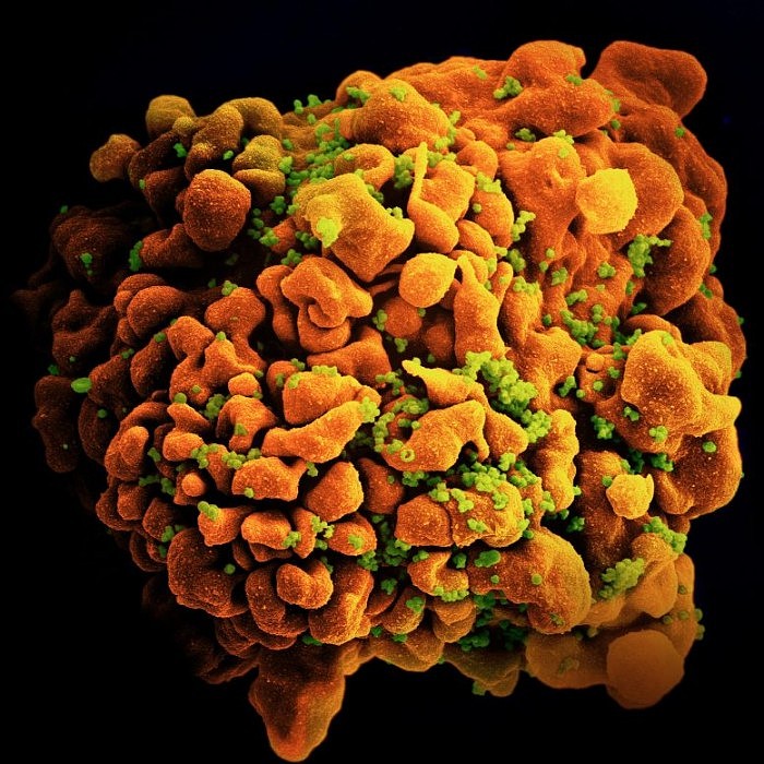 Scanning-Electron-Micrograph-of-HIV-Infected-H9-T-Cell-777x777.jpg