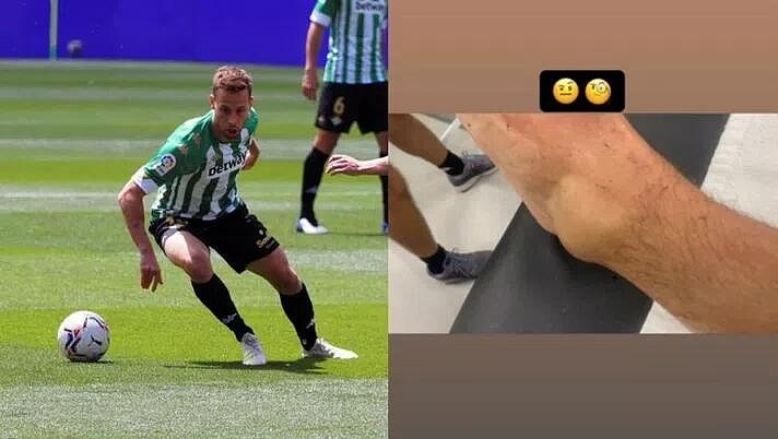 贝蒂斯中场核心发脚踝受伤肿胀照片，批评罗马球员扎尼奥洛下黑脚