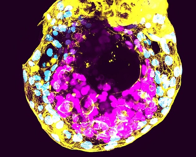 图1：一个在实验室中生长了12天的人类胚胎，可以看到将形成胚胎本身（紫红色）的细胞。