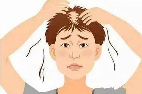 神经性脱发的症状表现 神经性脱发怎么治疗 - 2