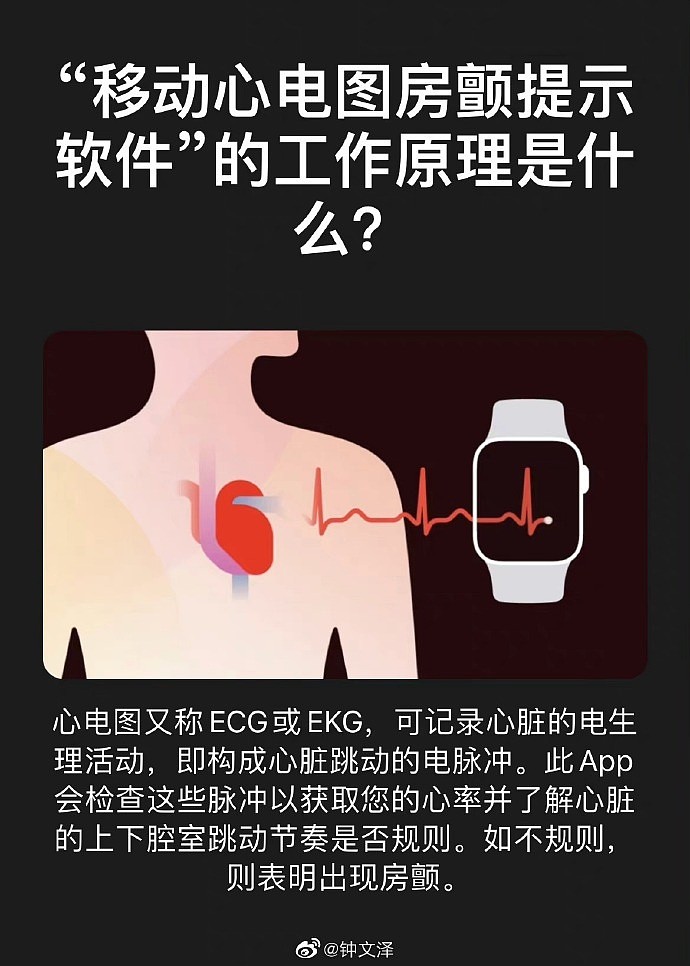 国行Apple Watch终于获得“完全体” ECG心电图已上线测试版系统 - 2