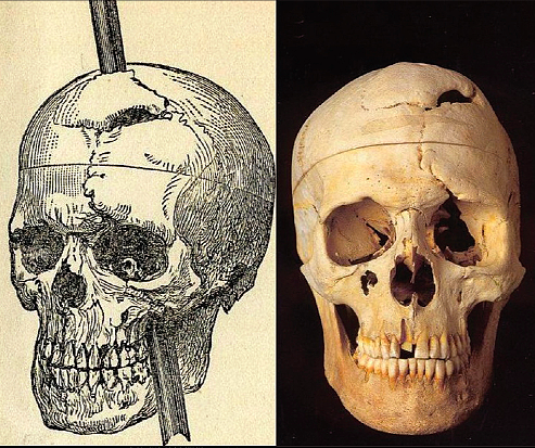 史上最传奇的头骨：被铁棒贯穿，被挖坟研究，最终登上 Science 封面 - 7