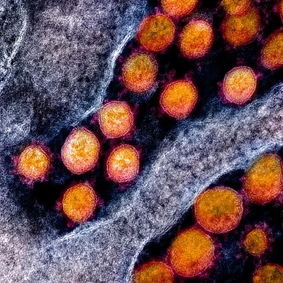 全球首个主动感染新冠病毒的人体试验结果公布 - 2