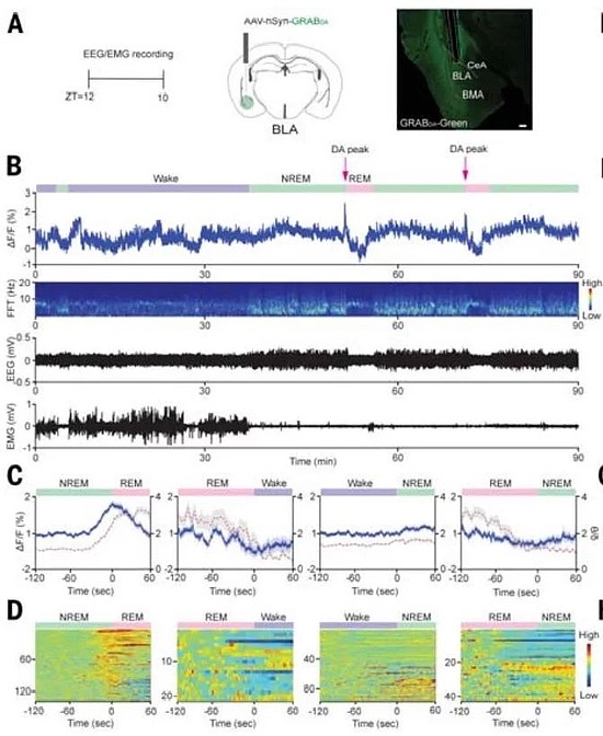 沉迷做梦？最新《科学》找到了进入梦乡的“钥匙” - 2