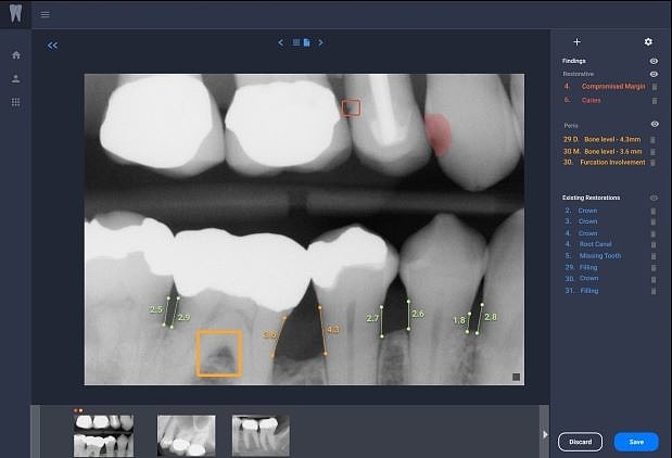 Overjet获2700万美元新投资 致力推动牙科X光片AI分析工具的普及 - 1