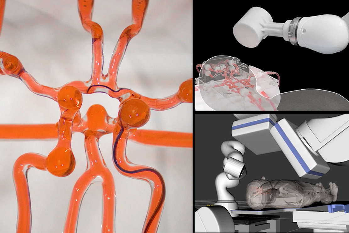 MIT新型手术机器人让外科医生可以对中风患者进行远程手术 - 1