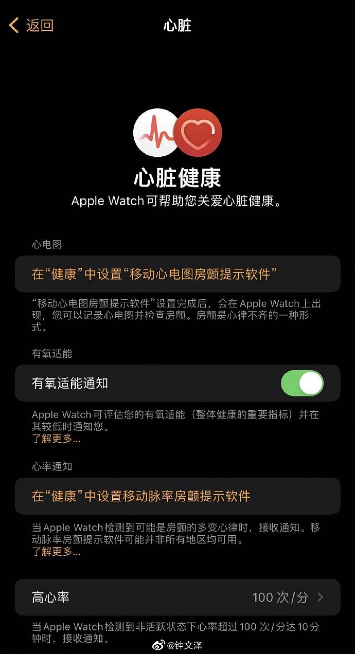 国行Apple Watch终于获得“完全体” ECG心电图已上线测试版系统 - 3