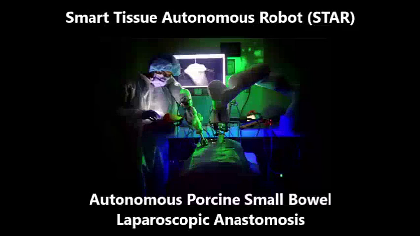 全球首次：手术机器人自主完成猪体内腹腔镜手术 - 2