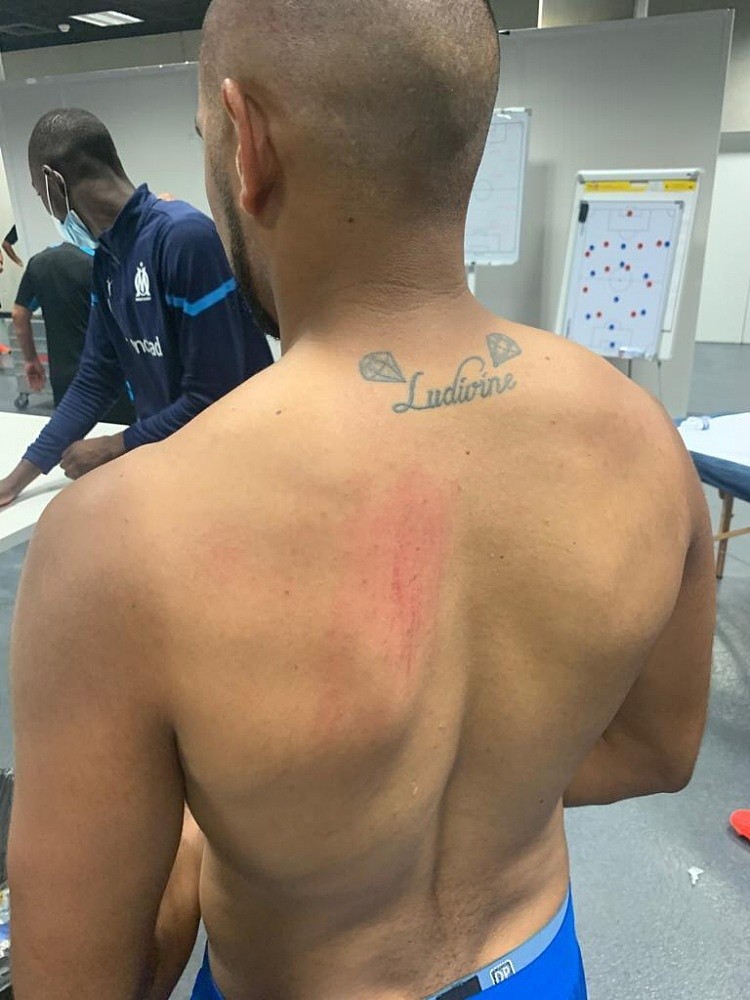 血痕清晰可见，帕耶、贡多齐、卢安-佩雷斯在骚乱中受伤 - 2