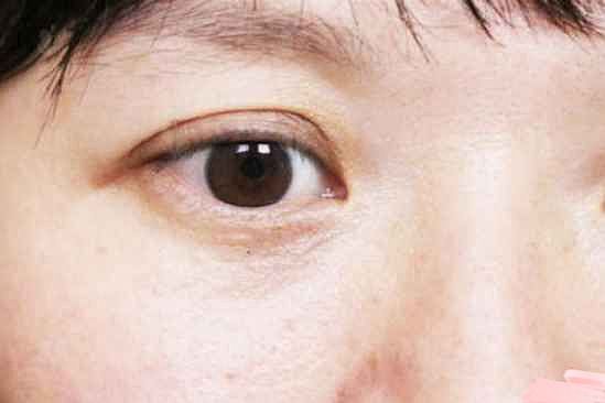 维生素e加凡士林可以去眼纹吗 怎么用去眼纹 - 1