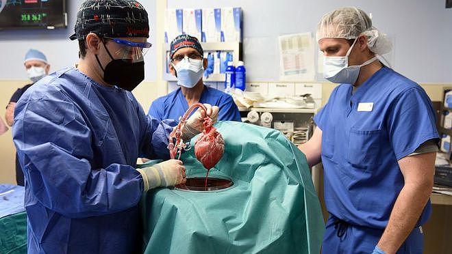 美国医生为患者移植猪心脏 术后病人情况良好 - 1