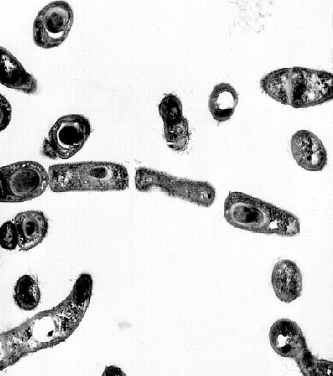 transmission-electron-micrograph-of-bacillus-anthracis-482x544.jpg