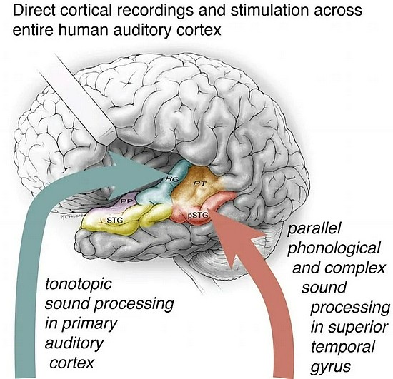 改写理论，华人神经科学家揭示大脑处理语音的运行机制 - 4