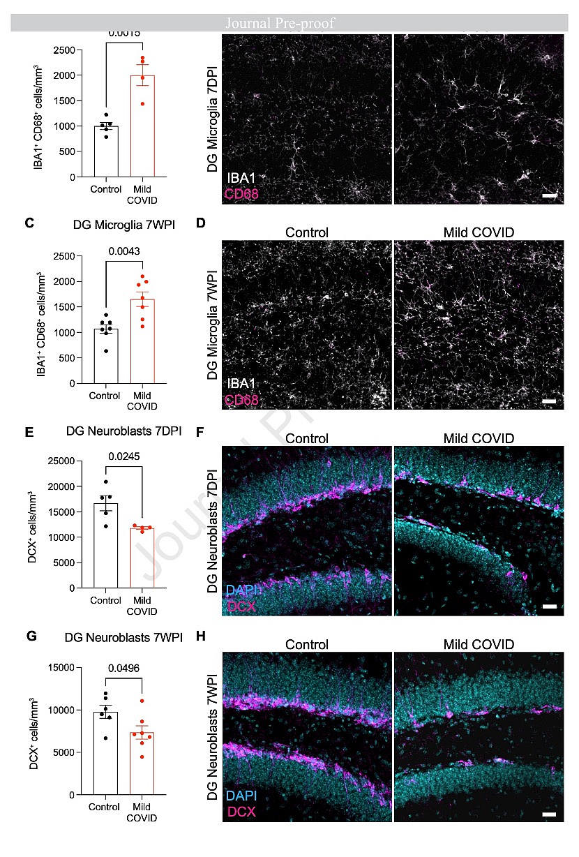 斯坦福、耶鲁研究：新冠感染轻症仍可能导致神经细胞和髓鞘失调 - 5