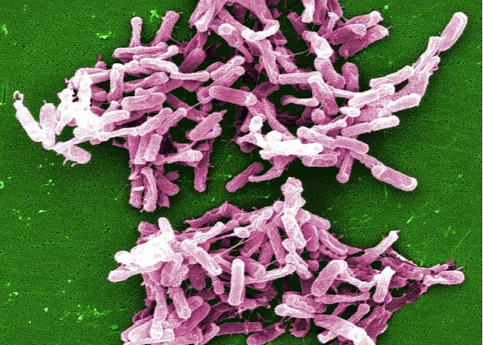 [图]科学家发现致病性肠道细菌和低热量饮食存在关联 - 1