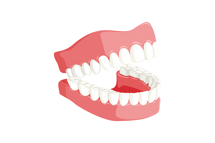 研究称牙齿脱落与痴呆症风险有关 但原因仍然难以解释 - 1