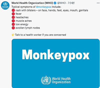 以色列确诊首例猴痘 WHO：或有更多不明传播链病例 - 2