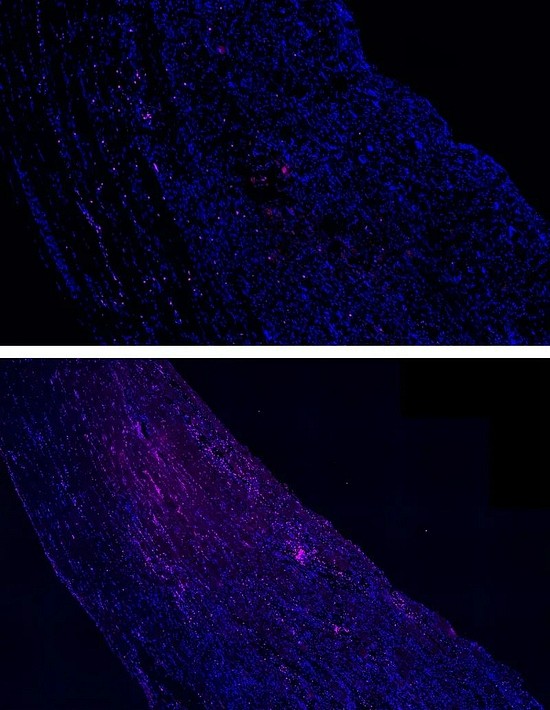 难怪按摩这么舒服：哈佛科学家首次揭示按摩促进肌肉修复的原理 - 4