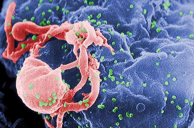 研究显示：感染了新冠的HIV患者容易产生新冠病毒变异 - 1