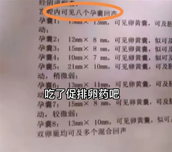 郑州一女子不规范使用促排卵药怀上八胞胎 - 1