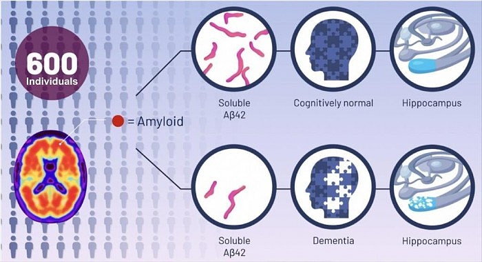 Alzheimers-Theory-New-Discovery.jpg