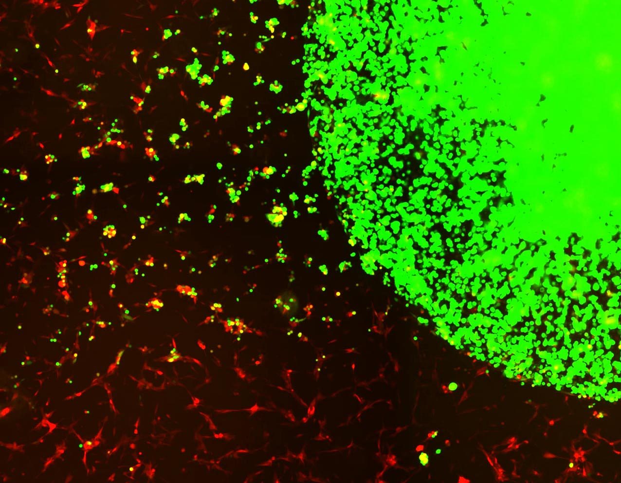 科学家利用“现成的”工程干细胞治疗侵袭性脑癌 - 1