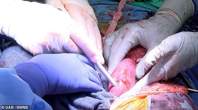 成功移植猪心脏之后 美国脑死亡者成功移植两个猪肾 - 2