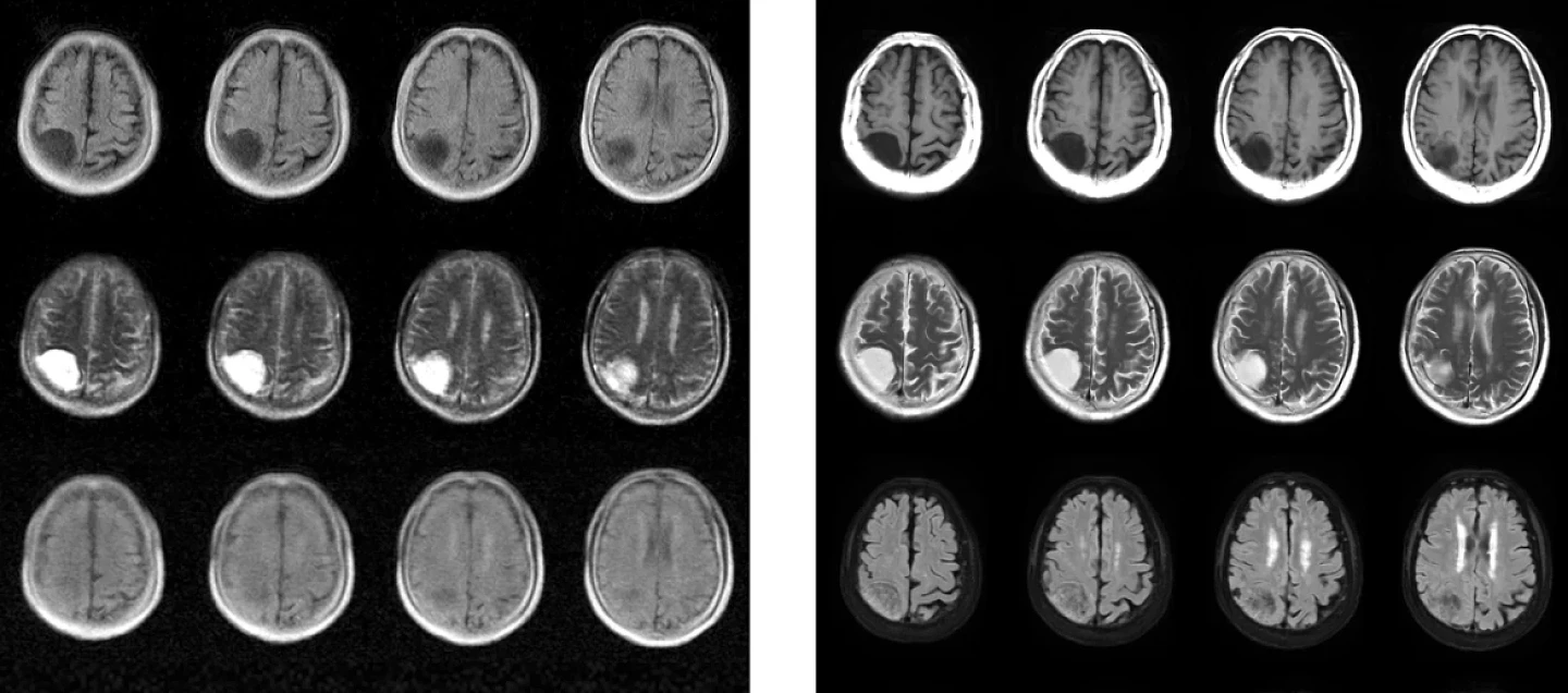 便携式MRI能以极低的成本实现对脑部疾病的检测 - 1